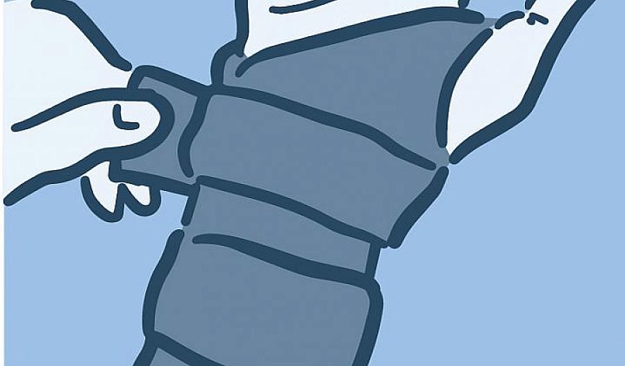 Ilustración de una ortesis de mano