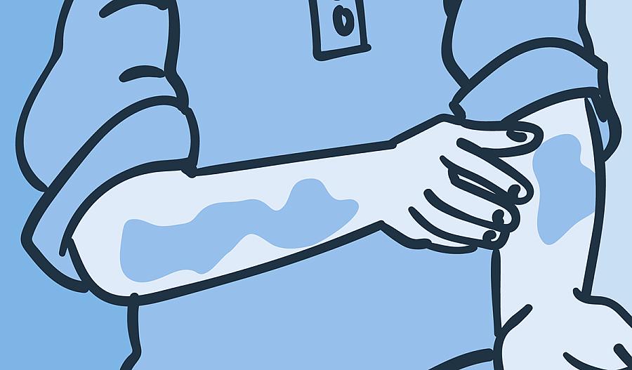 Ilustración de un hombre tocando unas irritaciones en sus brazos.